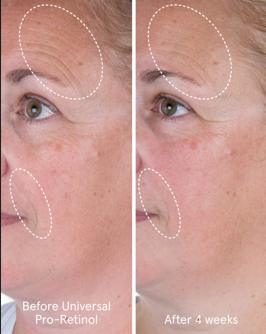 Universal Pro-Retinol