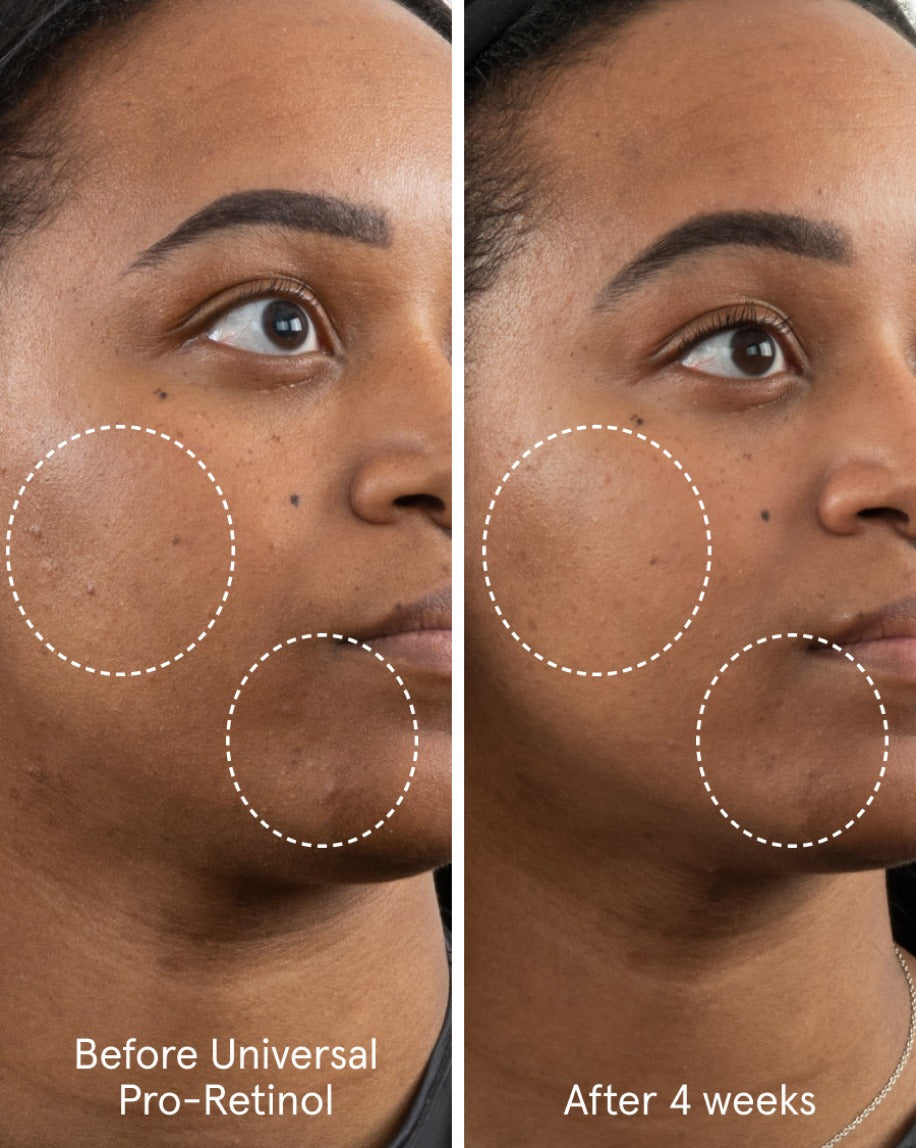 Universal Pro-Retinol