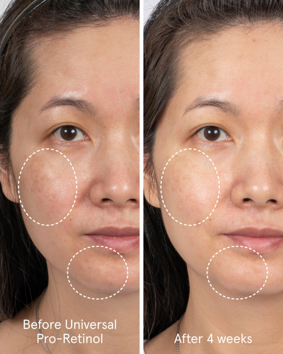 Universal Pro-Retinol